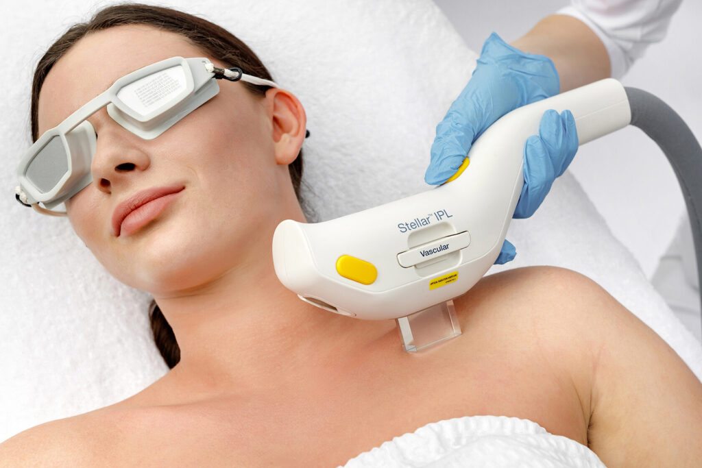 IPL treatment for skin rejuvenation at SF Aesthetic Medspa, New Lenox IL