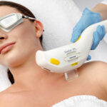 IPL treatment for skin rejuvenation at SF Aesthetic Medspa, New Lenox IL