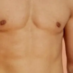 شفط الدهون في جدة للحصول على جسم أكثر رشاقة وتناسق