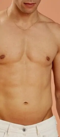 شفط الدهون في جدة للحصول على جسم أكثر رشاقة وتناسق