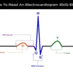 ECG in Dubai – Reliable Heart Monitoring and Diagnostic Care