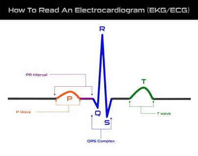 ECG in Dubai – Reliable Heart Monitoring and Diagnostic Care