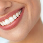 Veneers Dubai